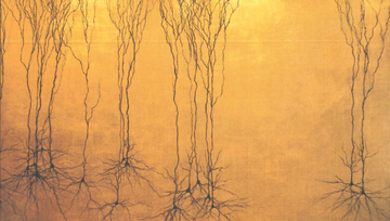 hippocampal pyramidal neurons against a yellow background